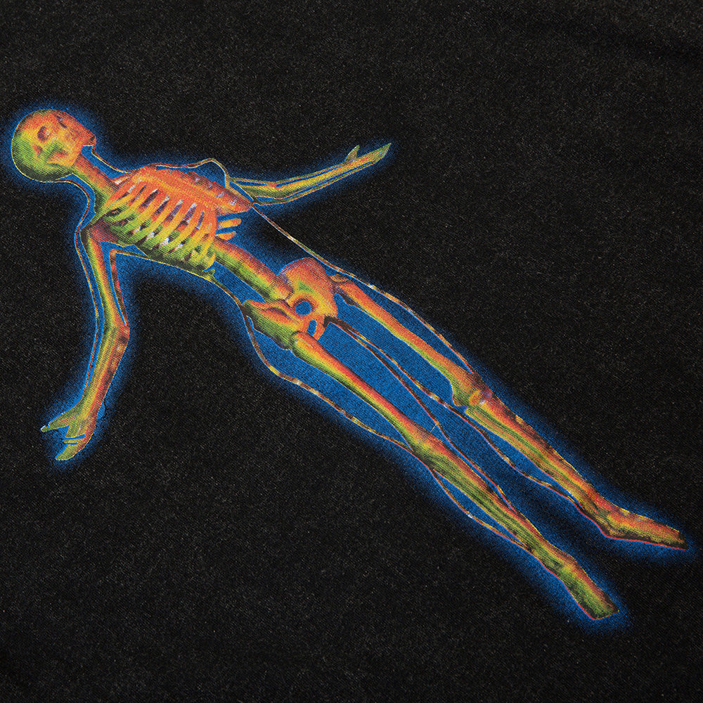 "X-Ray" Tee